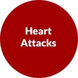 Heart- Attacks