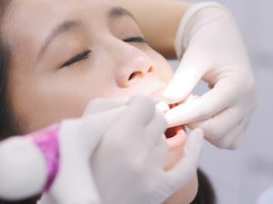 Oral Health Professionals Warn Against TikTok “Dental Hacks”