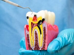 Gum Health and Periodontal Disease: Signs You Should Not Ignore